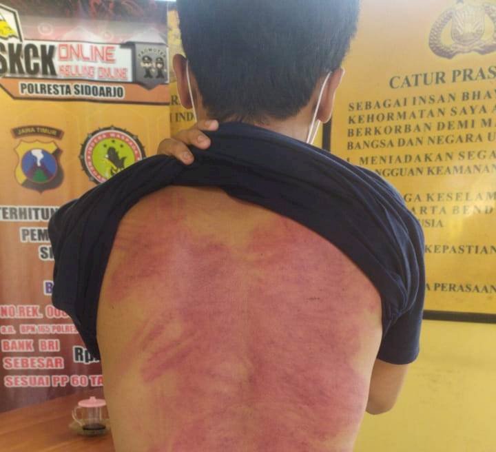 Pemuda Dikeroyok Puluhan Orang, Dilaporkan ke Polsek Sedati