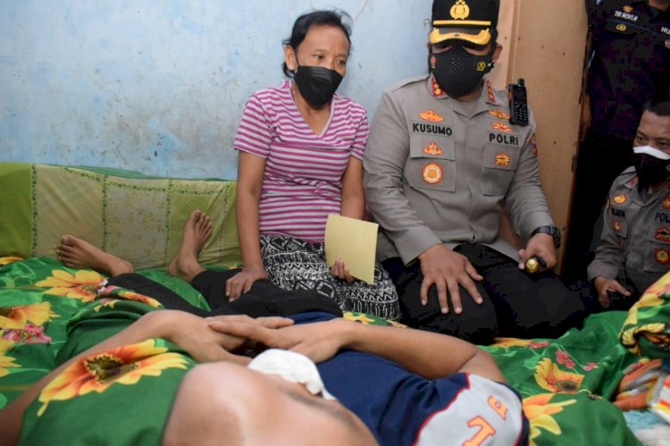 Kapolresta Sidoarjo Kunjungi  Warga Sakit Tumor Mata