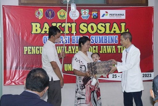 FKG RSGMP Unej dan PDGI Jatim Gelar Operasi Bibir Sumbing