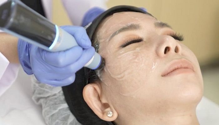 Tips Tetap Cantik saat Puasa dengan Profira Exion HA, Bantu Kulit Wajah Tetap Lembab dan Cerah